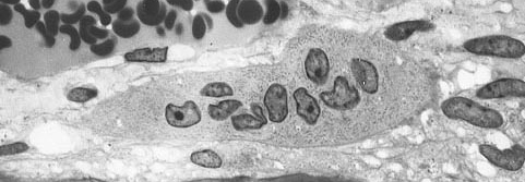 Osteoklast im Transmissionselektronenmikroskop (TEM) - Schwarz-Weiß-Aufnahme - Besonders gut zu sehen sind die vielen Zellkerne. 