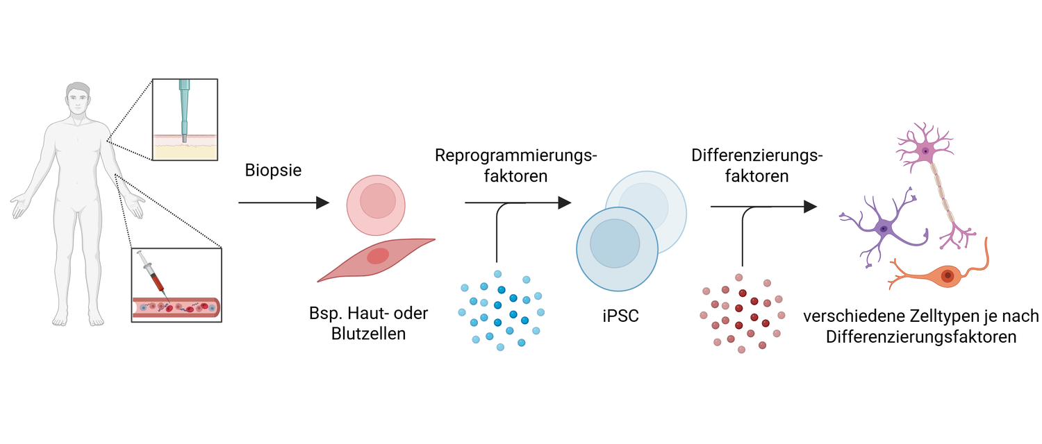 Ein Ablaufschema, wie man aus Körperzellen induzierte pluripotente Stammzellen herstellt. 