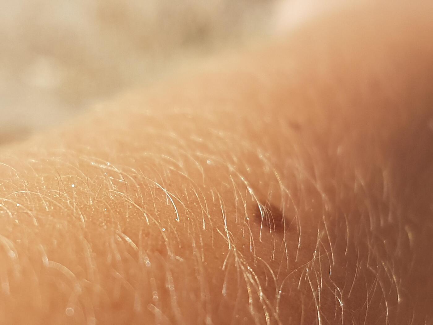 Menschliche Haut, vielleicht ein Arm, mit feinen Härchen und einem Muttermal.