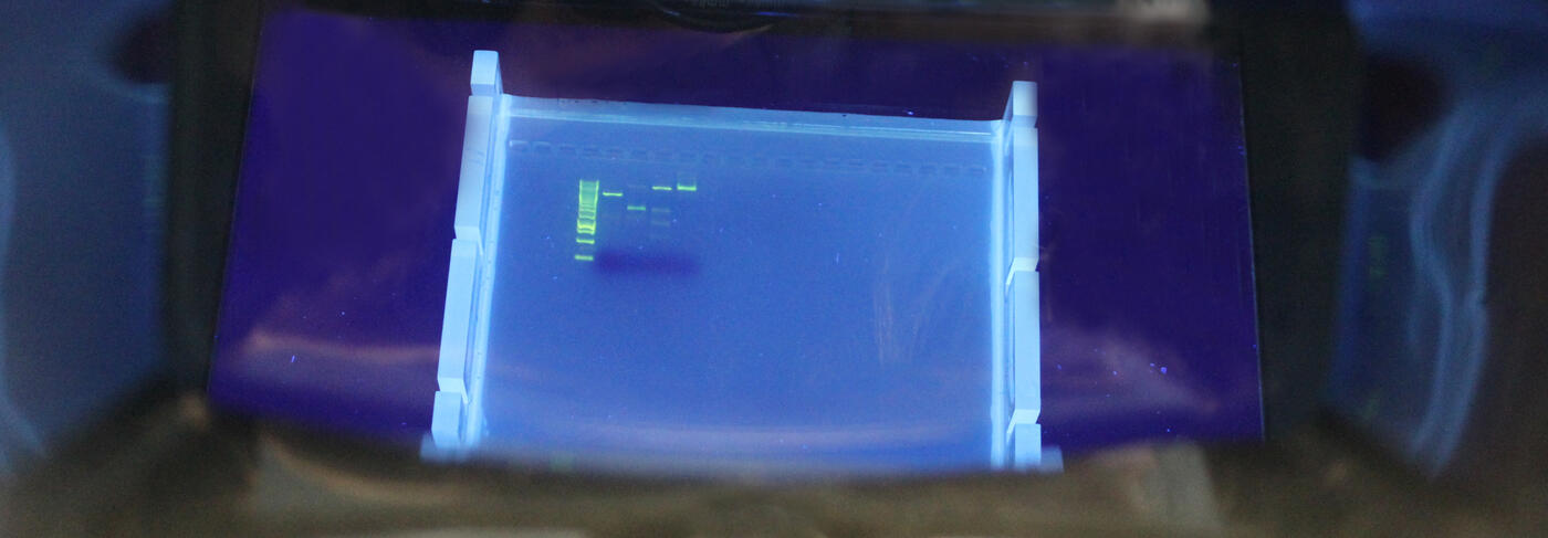 Agarosegel mit aufgetrennten DNA-Banden im UV-Licht-Transilluminator