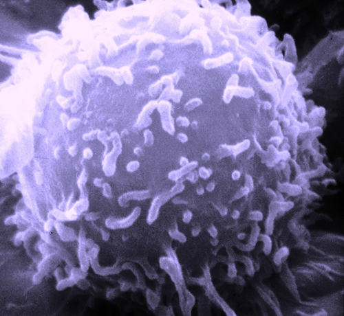 T-Zelle/T-Lymphozyt im Raster-Eleketronenmikroskop (REM) - nachträglich violett eingefärbt 