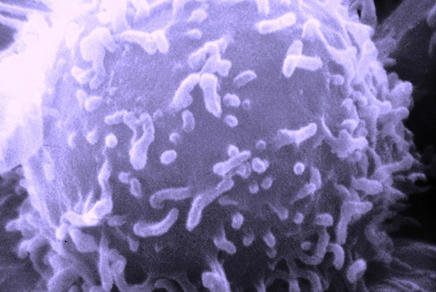 T-Zelle/T-Lymphozyt im Raster-Eleketronenmikroskop (REM) - nachträglich violett eingefärbt 