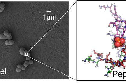 Links: Silikapartikel, die durch molekulare Schablonen aus Eiweiß in ca. 1 mikrometer große Kügelchen geformt wurden. Rechts: Eine Darstellung der Struktur der Eiweißschablonen im Inneren der Kügelchen. (Copyright: Dennis Kurzbach)