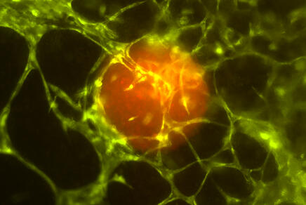 Tumorbild: Rot fluoreszierende Tumorsphäre in biogedrucktem Gewebe.